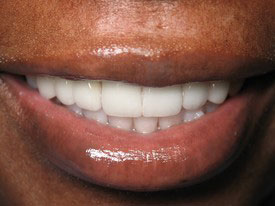 Prosmiles General and Cosmetic Dentistry | Implant Restorations, CBCT and Laser Dentistry