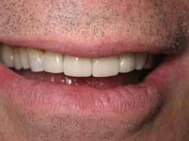 Prosmiles General and Cosmetic Dentistry | Digital Radiography, Cosmetic Dentistry and Ceramic Crowns