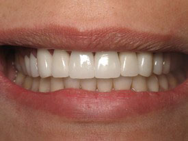 Prosmiles General and Cosmetic Dentistry | All-on-6, Digital Radiography and Laser Dentistry