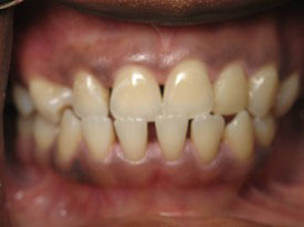 Prosmiles General and Cosmetic Dentistry | Digital Radiography, Dental Bridges and Dental Sealants