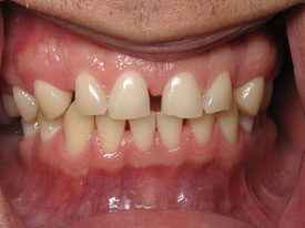 Prosmiles General and Cosmetic Dentistry | Emergency Treatment, Veneers and All-on-6