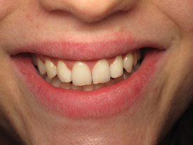 Prosmiles General and Cosmetic Dentistry | Implant Dentistry, Periodontal Treatment and Emergency Treatment