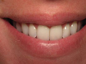 Prosmiles General and Cosmetic Dentistry | Dental Fillings, CBCT and Dental Sealants
