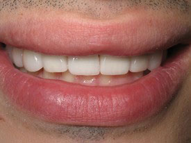 Prosmiles General and Cosmetic Dentistry | Dental Cleanings, TMJ Disorders and Implant Dentistry