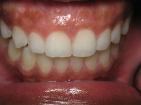 Prosmiles General and Cosmetic Dentistry | Full Mouth Reconstruction, CBCT and Periodontal Treatment