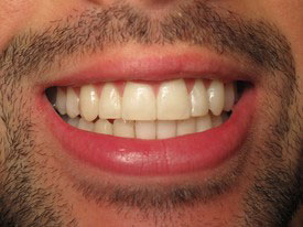 Prosmiles General and Cosmetic Dentistry | Extractions, Sedation Dentistry and Emergency Treatment