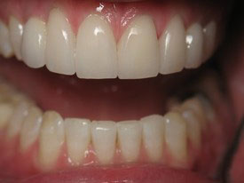 Prosmiles General and Cosmetic Dentistry | CBCT, Sports Mouthguards and Dental Cleanings