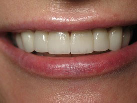 Prosmiles General and Cosmetic Dentistry | Oral Cancer Screening, Dental Fillings and Full Mouth Reconstruction