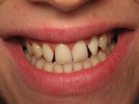 Prosmiles General and Cosmetic Dentistry | Laser Dentistry, Sports Mouthguards and Oral Cancer Screening