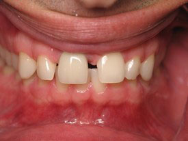 Prosmiles General and Cosmetic Dentistry | Dental Bridges, Emergency Treatment and Oral Cancer Screening