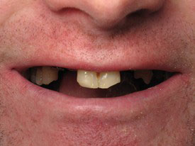 Prosmiles General and Cosmetic Dentistry | Crowns, Cosmetic Dentistry and Veneers