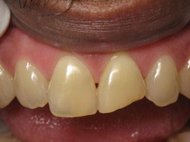 Prosmiles General and Cosmetic Dentistry | Teeth Whitening, Dental Cleanings and Sedation Dentistry