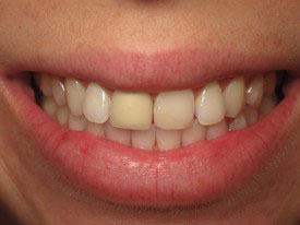 Prosmiles General and Cosmetic Dentistry | Periodontal Treatment, Root Canals and Crowns