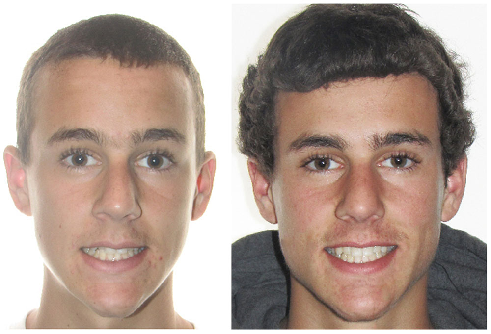 Prosmiles General and Cosmetic Dentistry