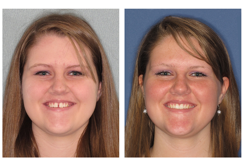 Prosmiles General and Cosmetic Dentistry