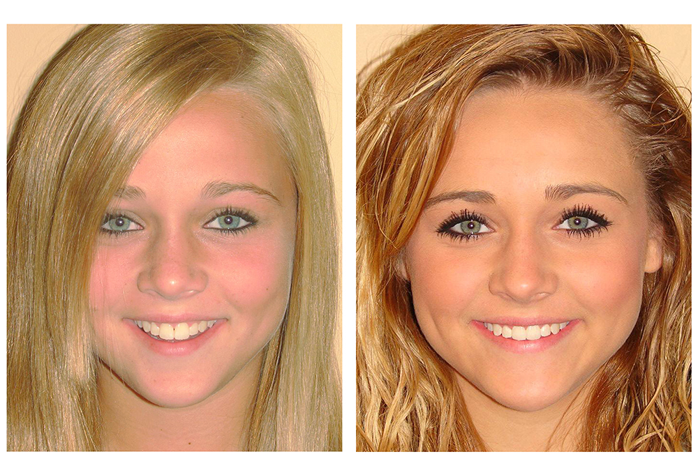 Prosmiles General and Cosmetic Dentistry