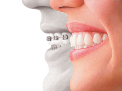 Prosmiles General and Cosmetic Dentistry | Ceramic Crowns, Dental Fillings and Digital Radiography