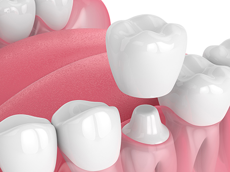 Prosmiles General and Cosmetic Dentistry
