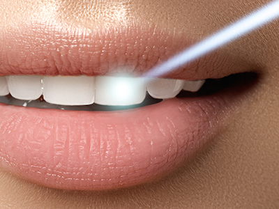 Prosmiles General and Cosmetic Dentistry | Sedation Dentistry, Dental Sealants and Cosmetic Dentistry
